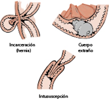 Obstrucción gastrointestinal, perro