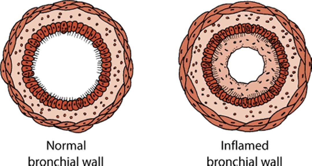 Tracheobronchitis