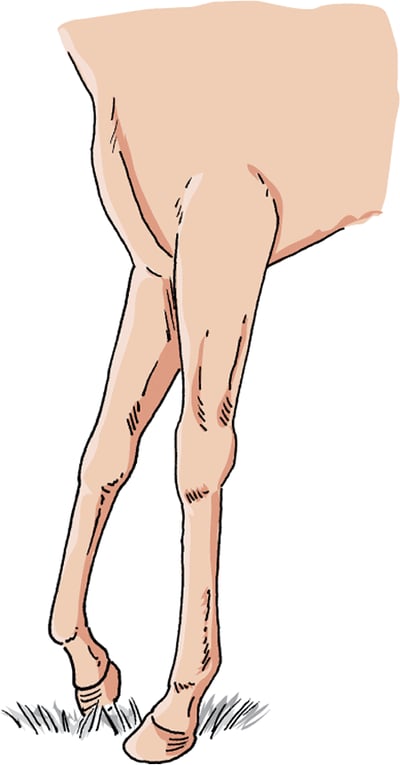 Contracted flexor tendons, foal