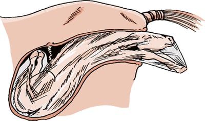 Parto del potro