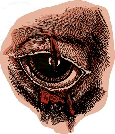 Eyelid tear, horse