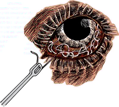 Eyeworms, horse