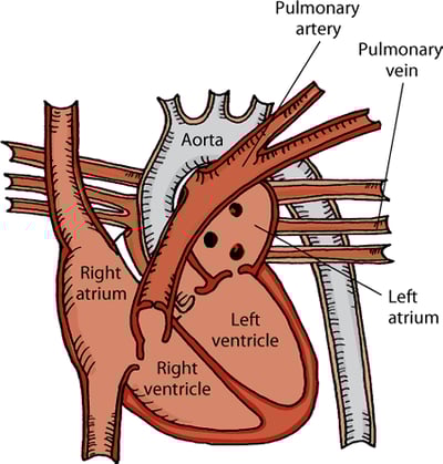 Horse heart
