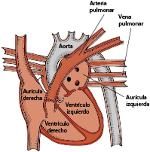 Corazón de caballo