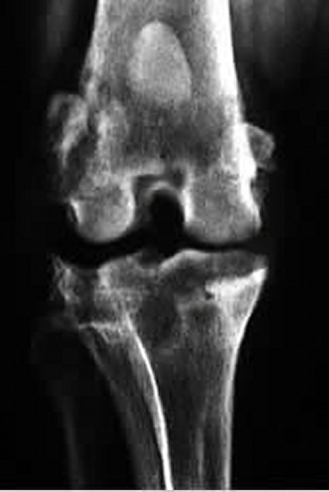 Degenerative joint disease, radiograph
