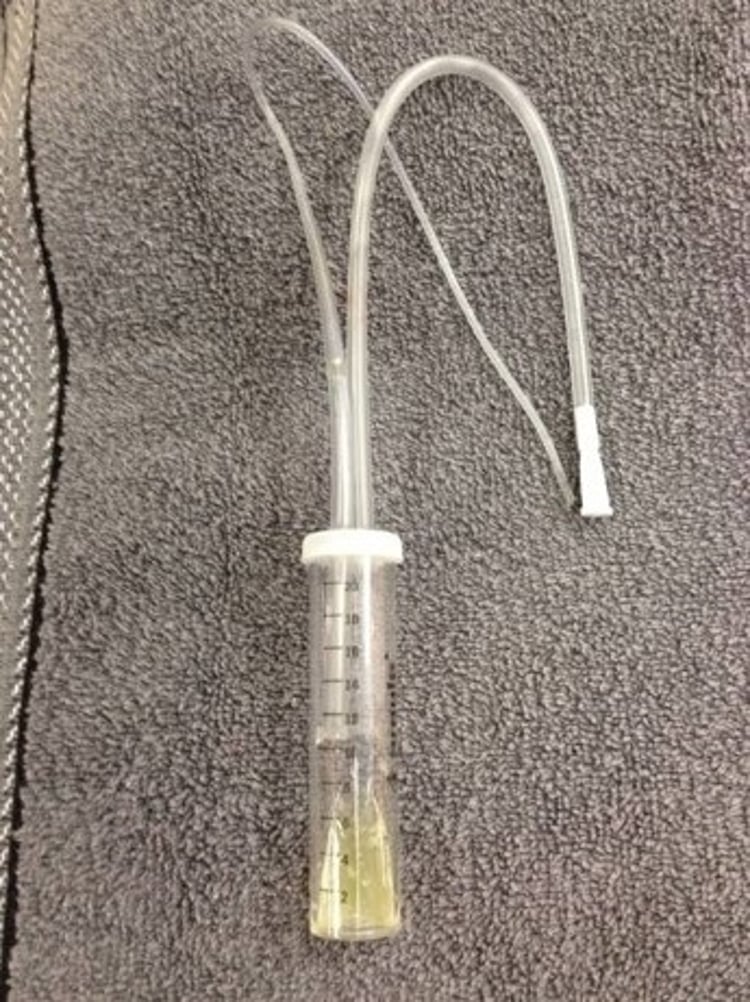DeLee aspirator after use, puppy