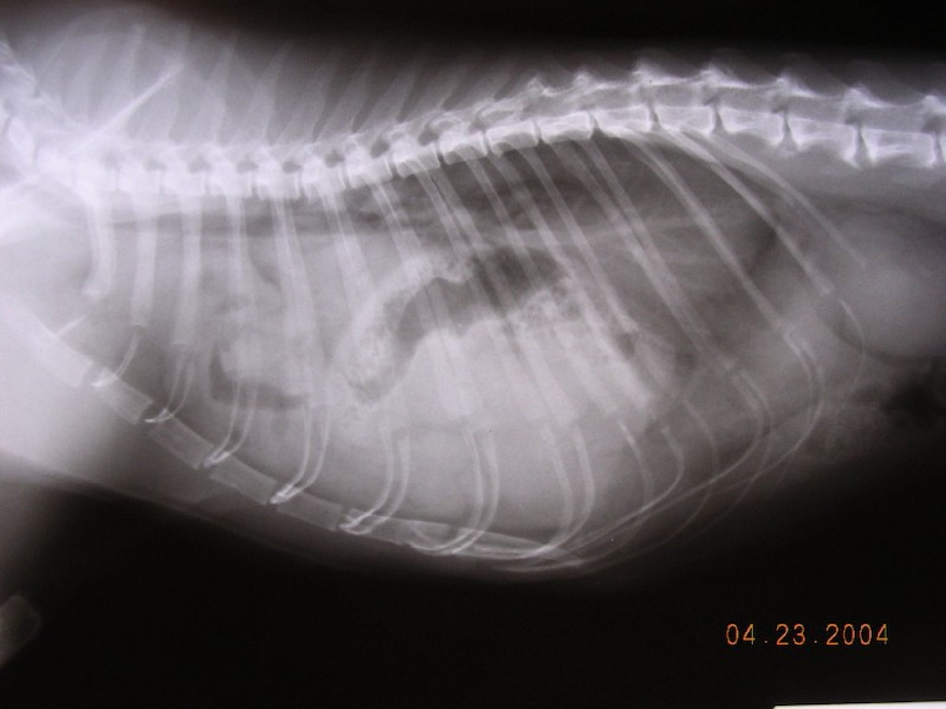Diaphragmatic hernia