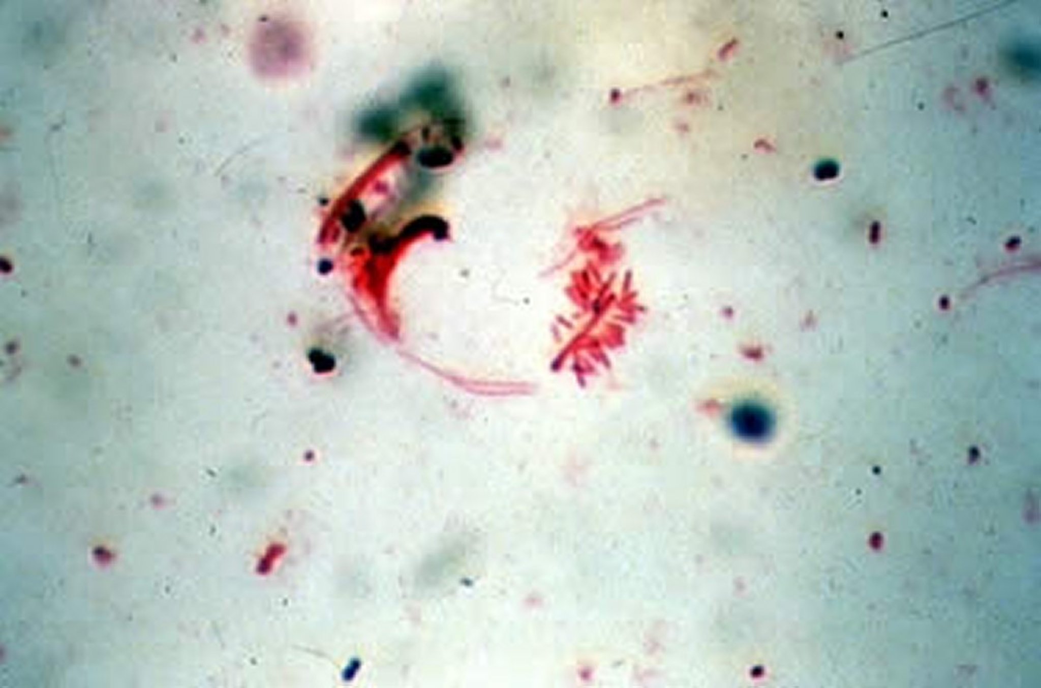 <i >Dichelobacter nodosus</i>, footrot lesion, sheep