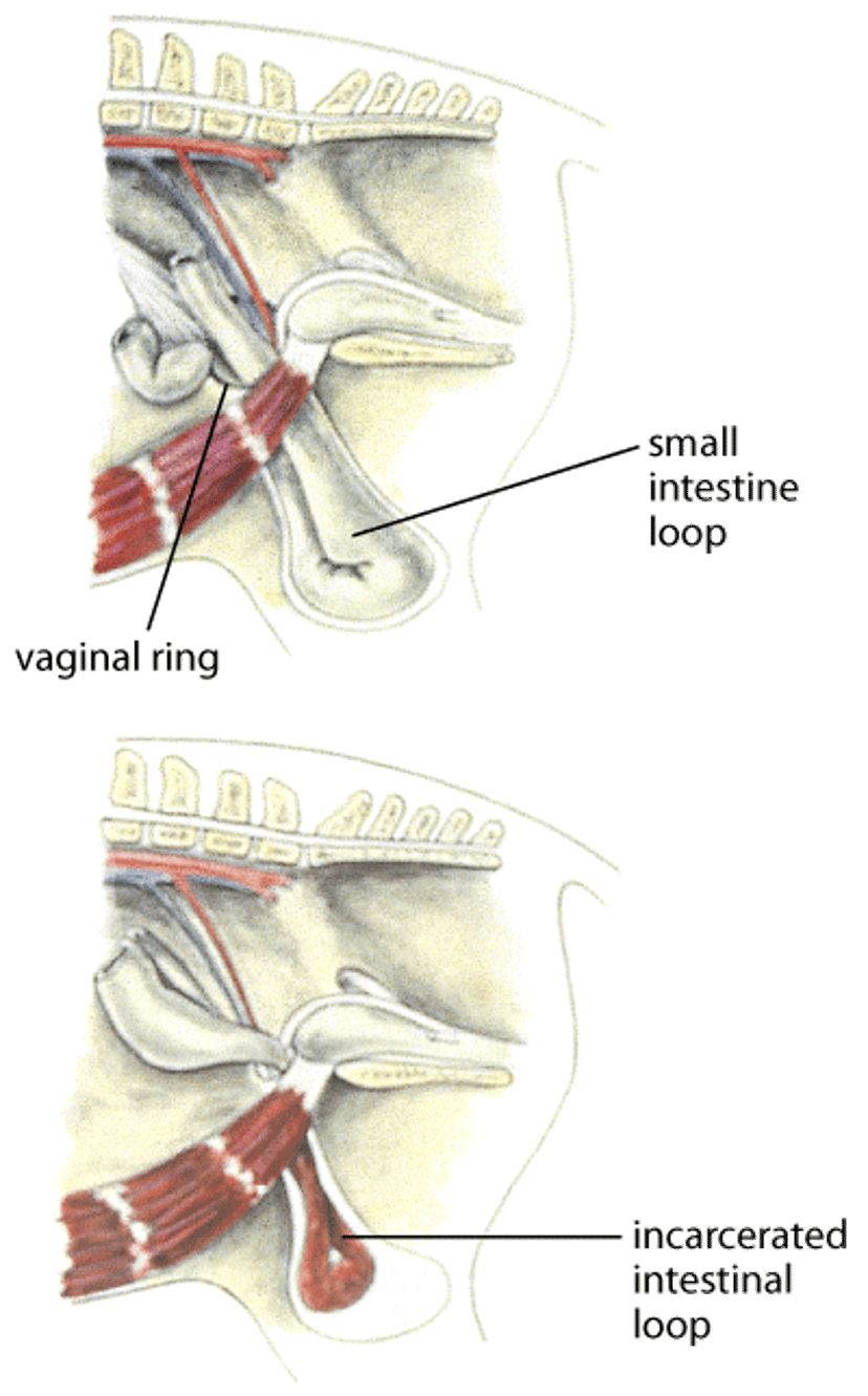 Inguinal hernia, horse