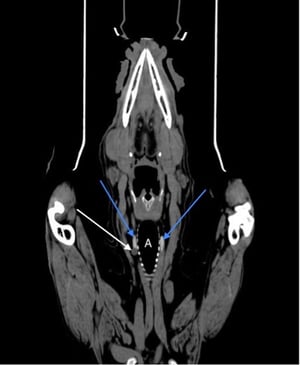 Parathyroid nodule, dorsal CT, dog