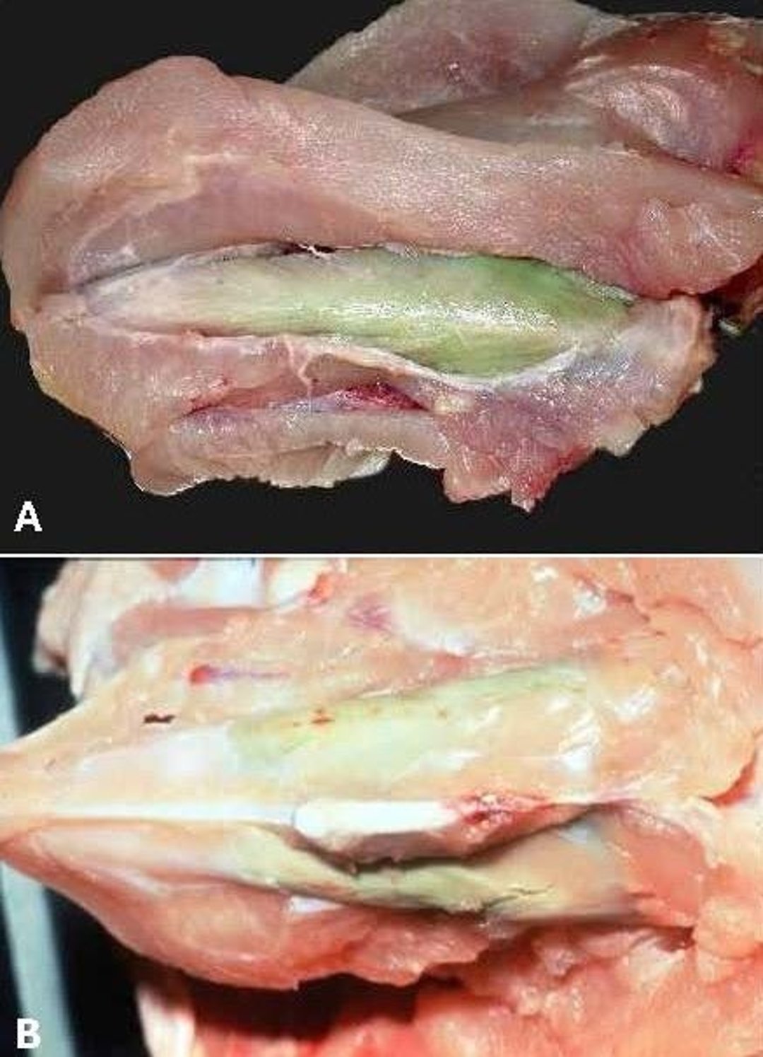 Deep pectoral myopathy, chickens
