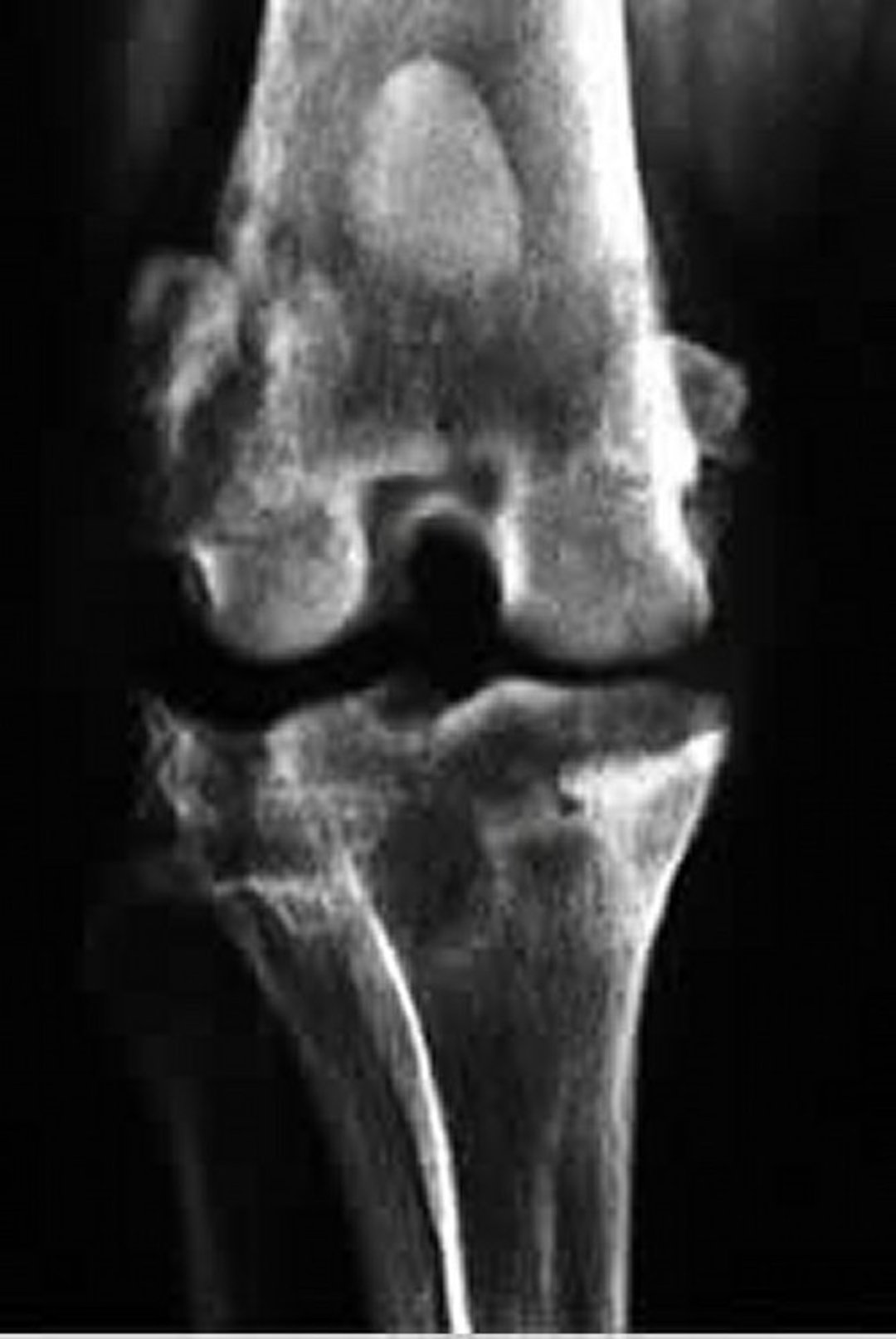 Degenerative joint disease, radiograph (ventrodorsal), dog