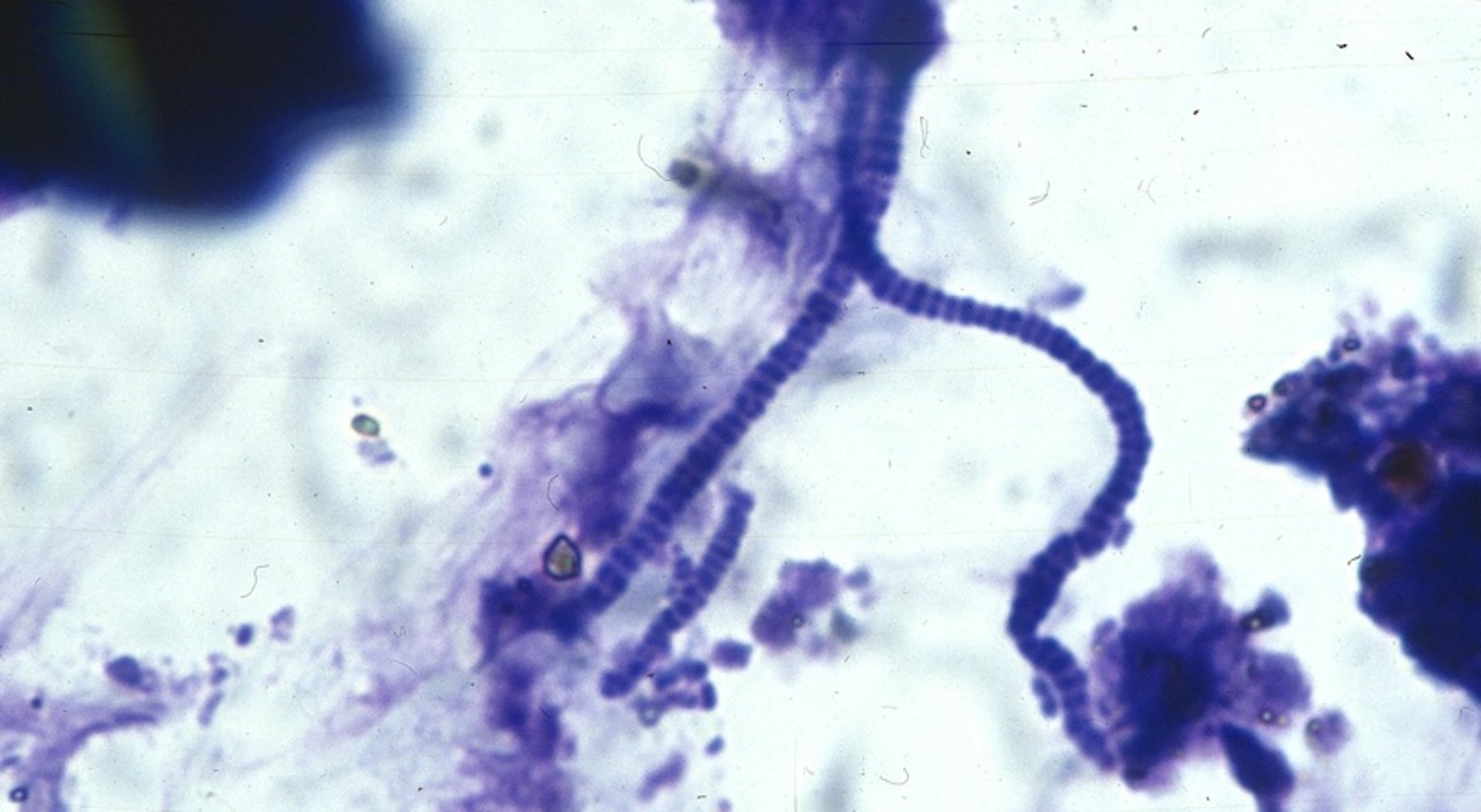 Dermatophilosis, photomicrograph
