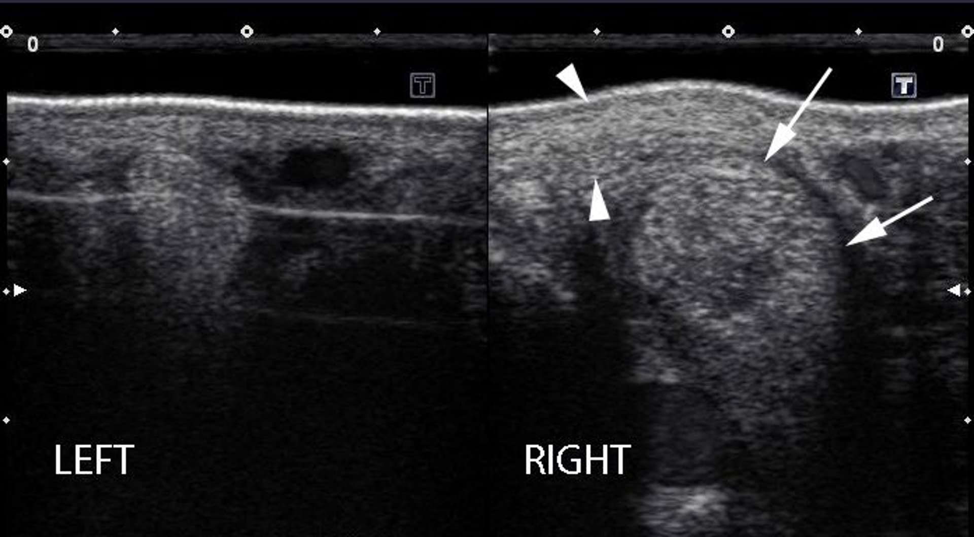 Desmitis, medial suspensory ligament branches, ultrasonographic images, horse