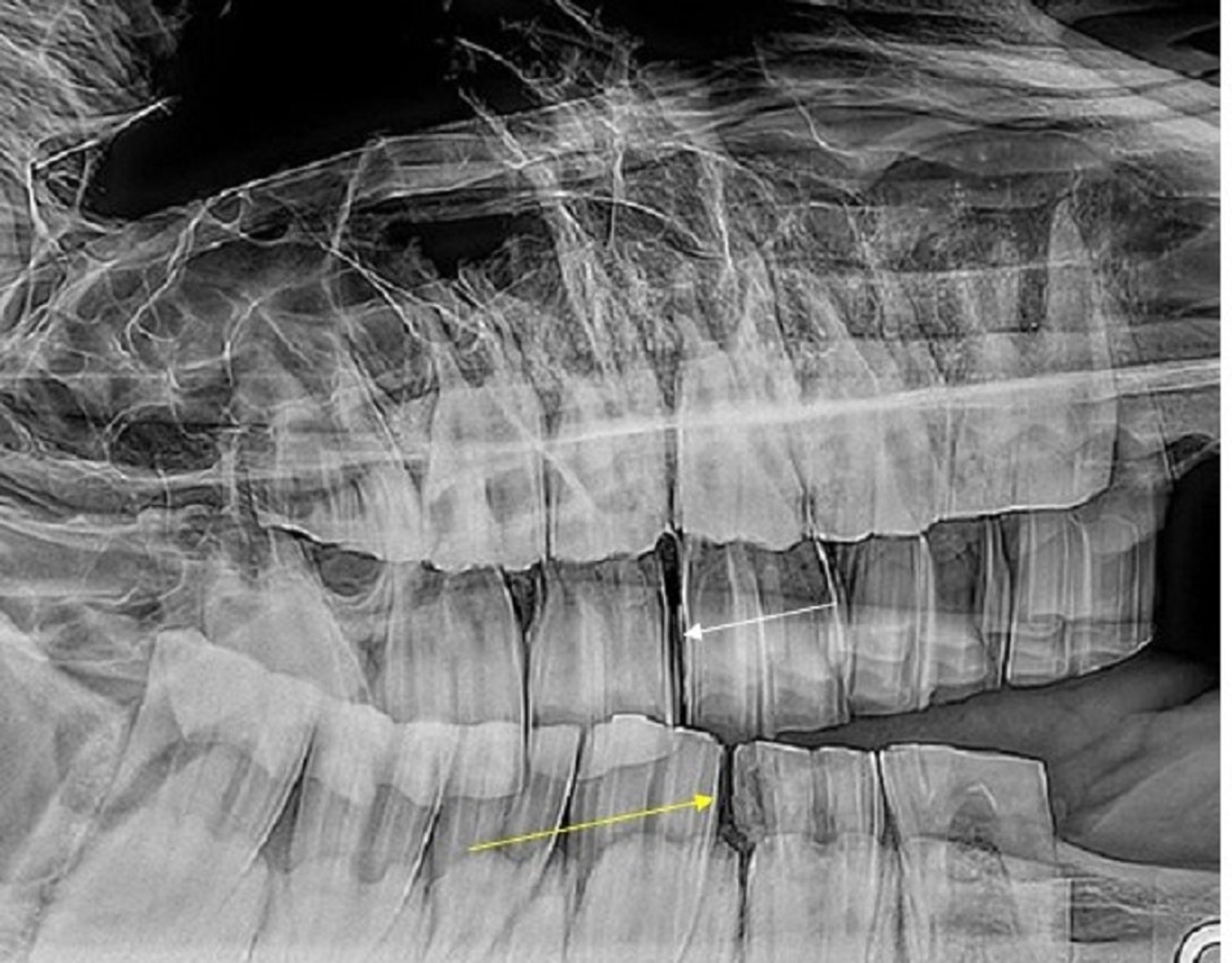 Diastema, caballo, radiografía