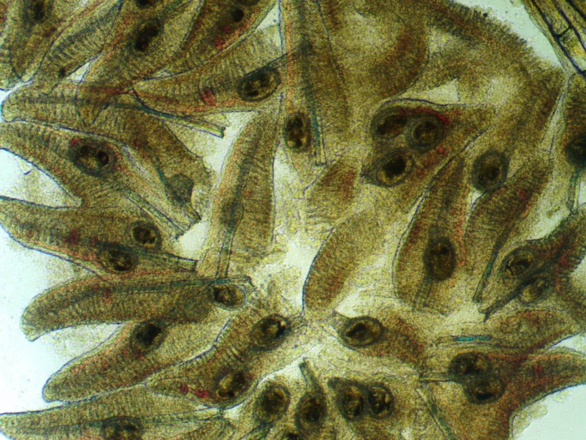 Metacercarias digeneas, agallas, xifo