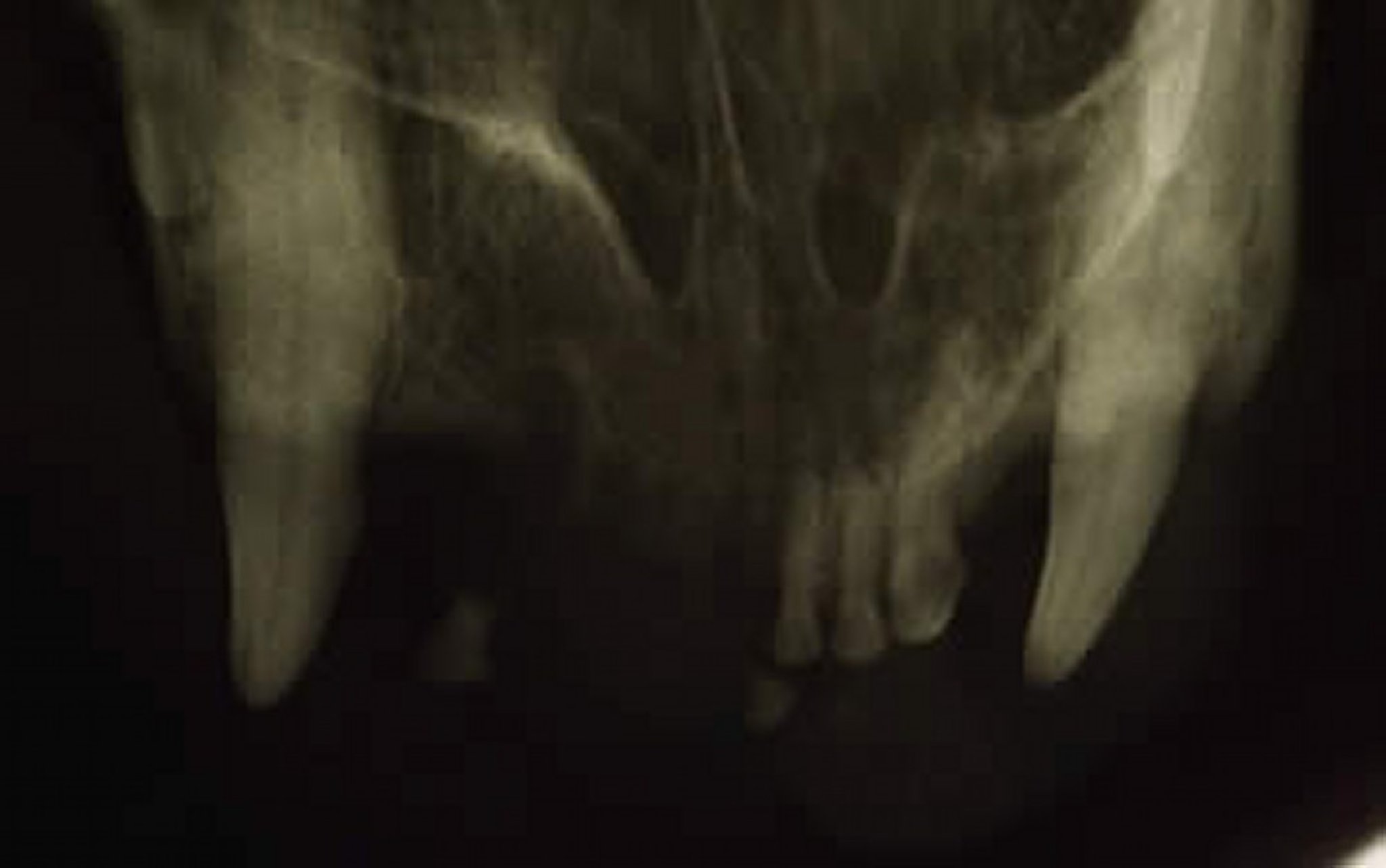 Melanoma oral maligno, gato, radiografía