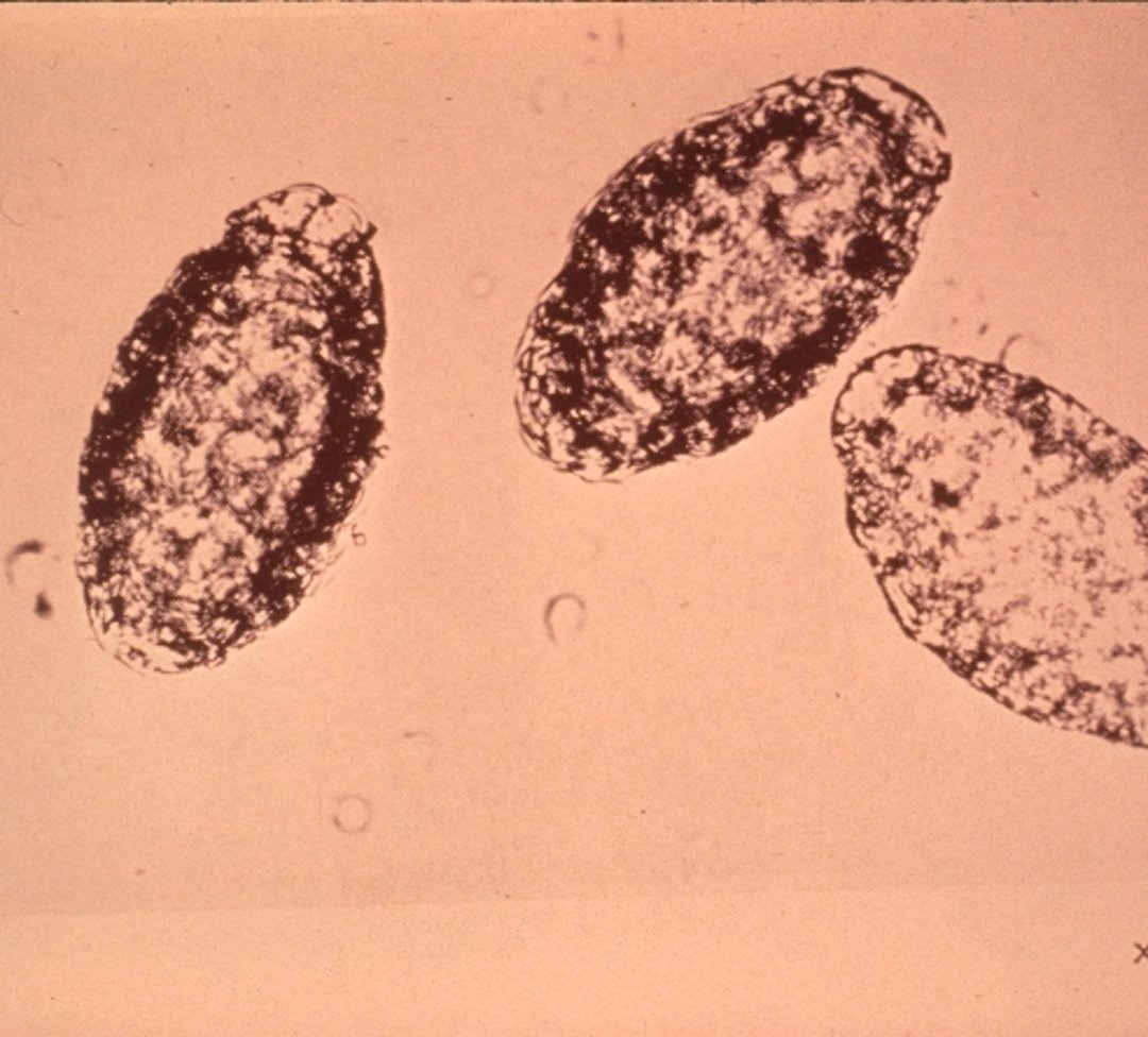<i >Dioctophyme renale</i>, eggs, photomicrograph