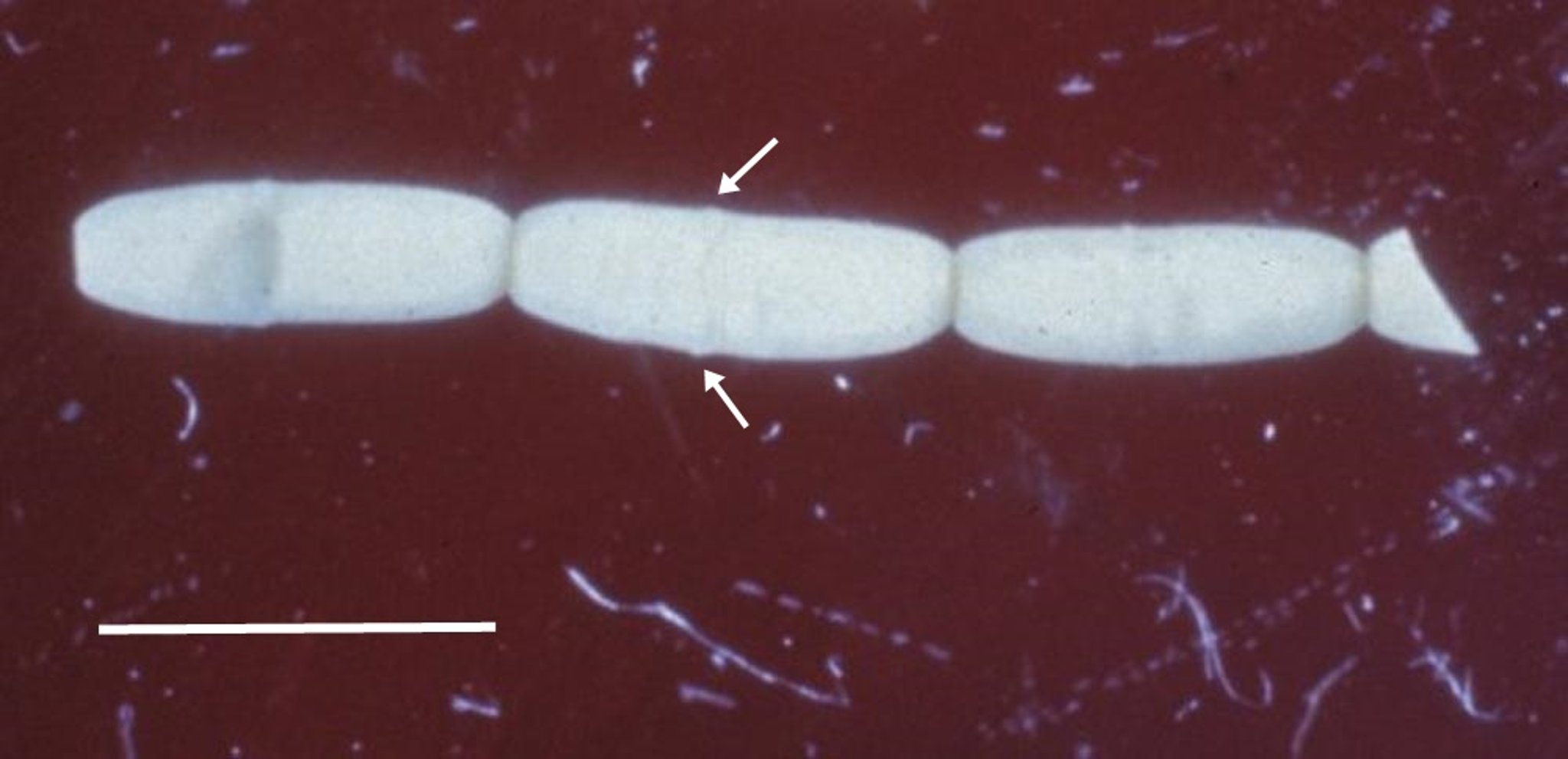Segmentos de um <i >Dipylidium caninum</i>, cão