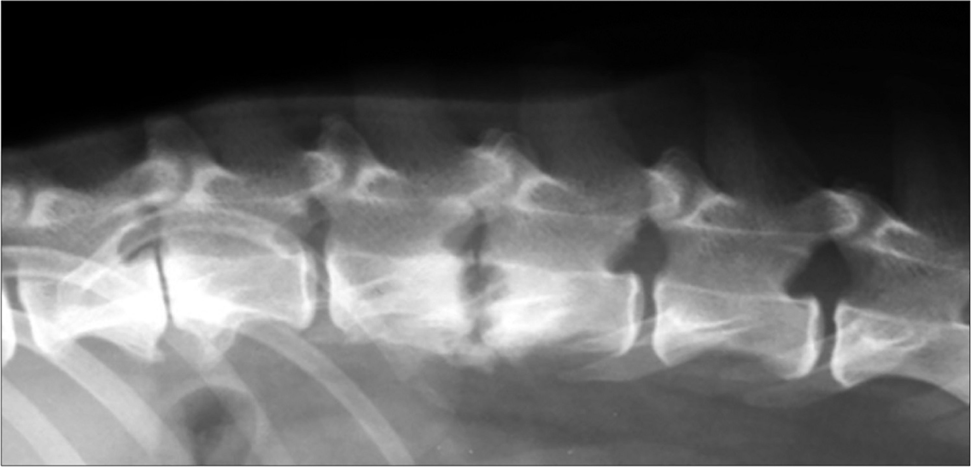 Discoespondilitis, perro