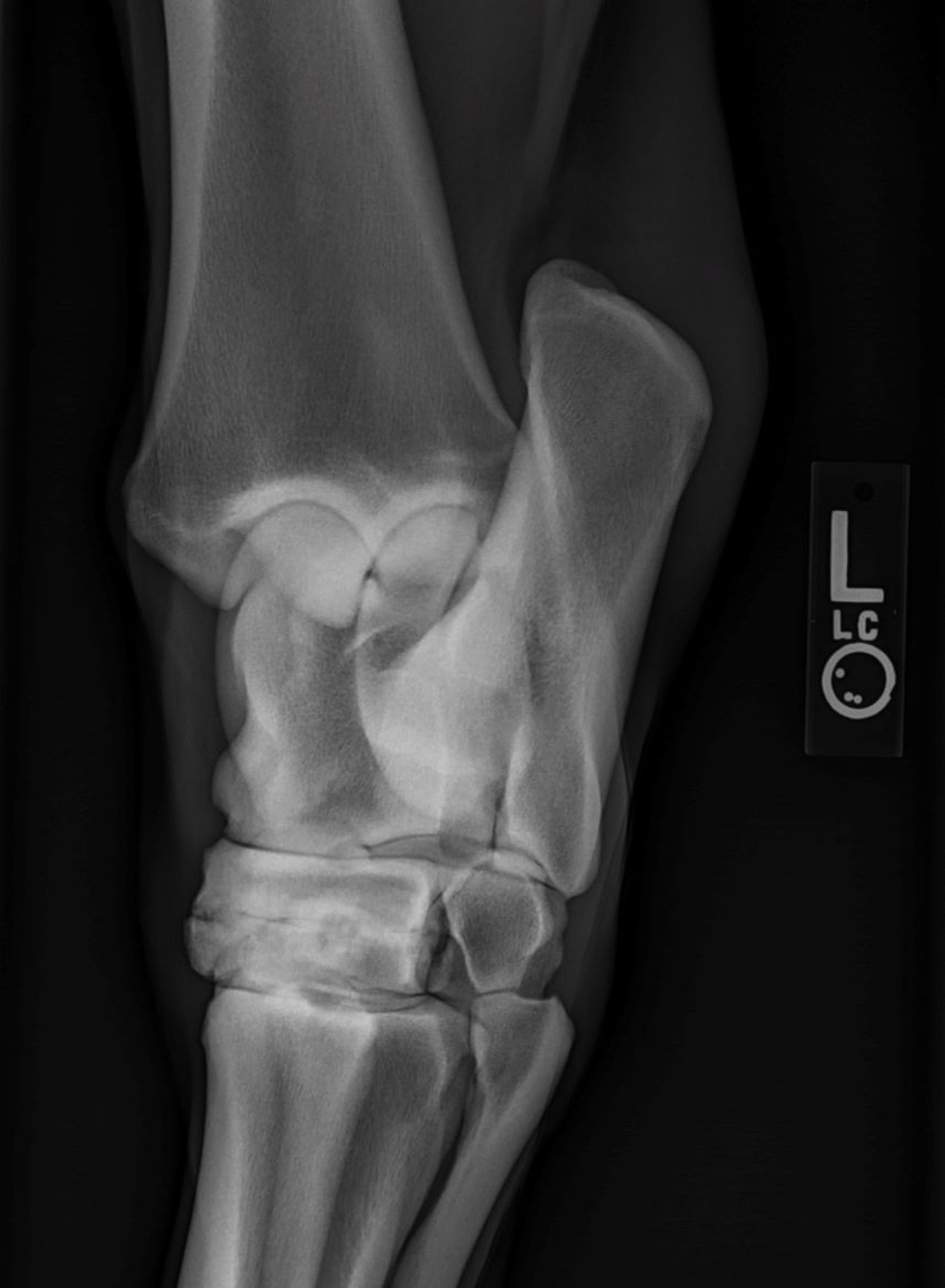 Distal intertarsal osteoarthritis, radiograph, horse
