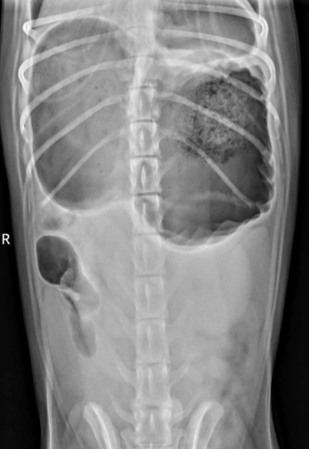 Double bubble radiograph, ventrodorsal view, dog