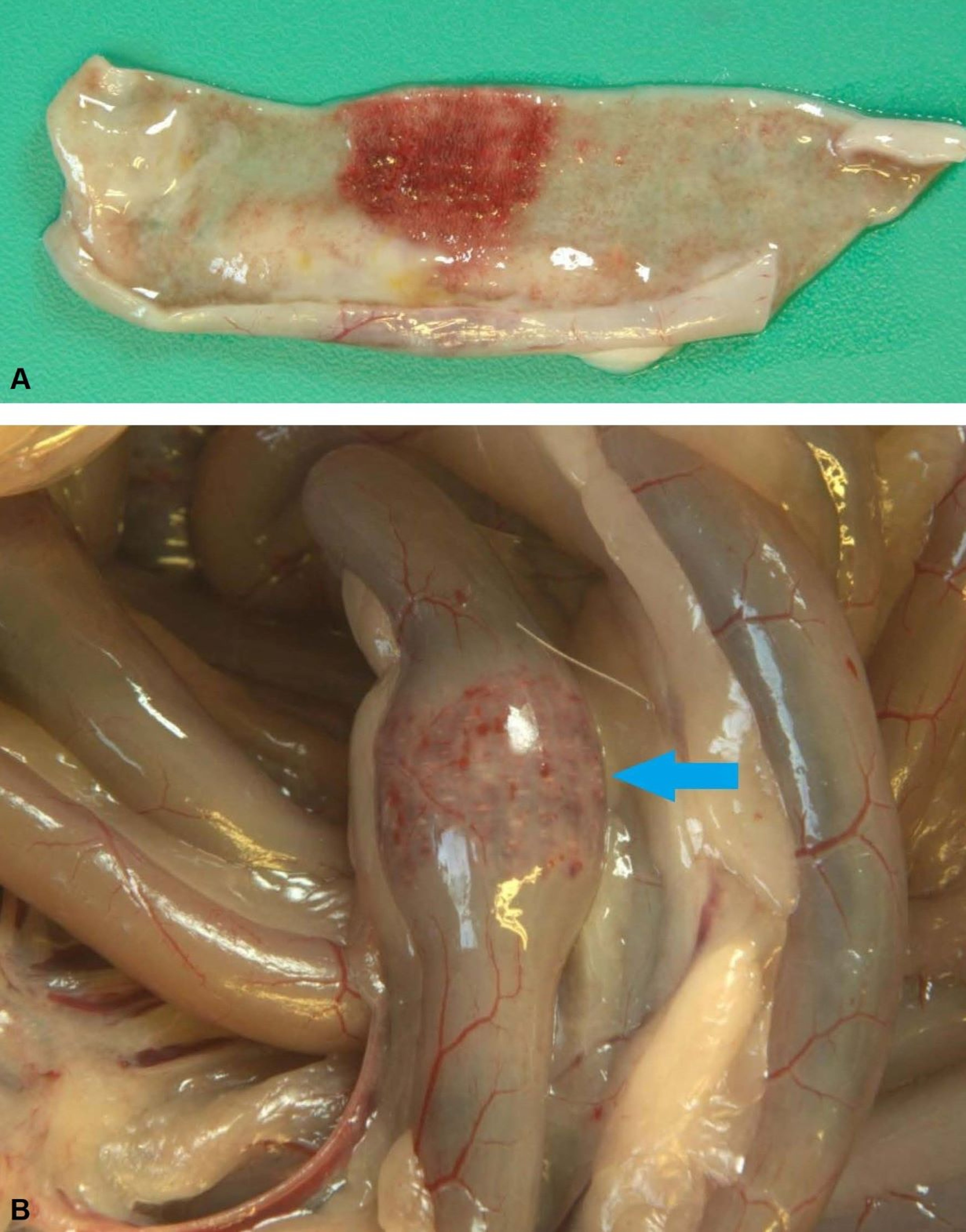 Duck viral enteritis, intestinal annular bands