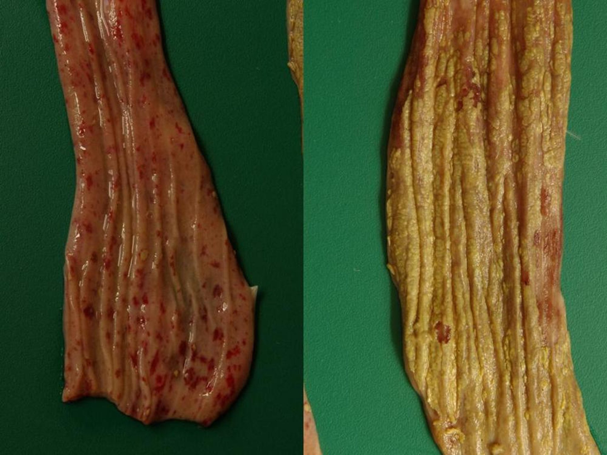 Enteritis viral del pato, hemorragias petequiales y equimóticas y membrana diftérica, esófago