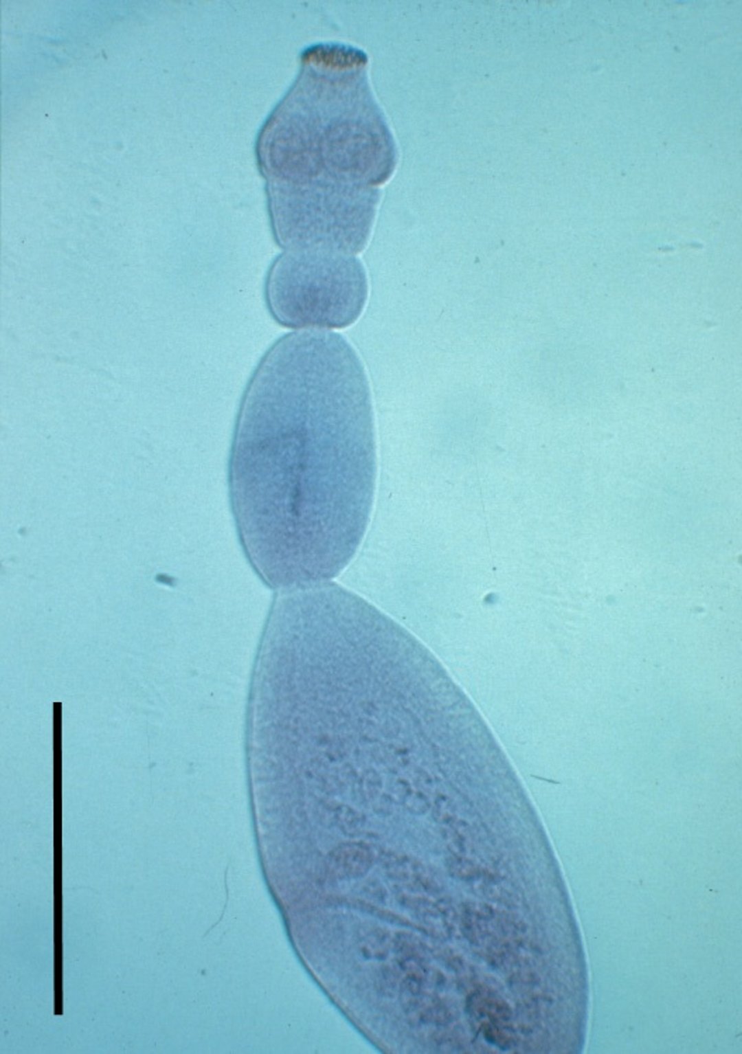 Adulto de <i >Echinococcus granulosus</i>, perro