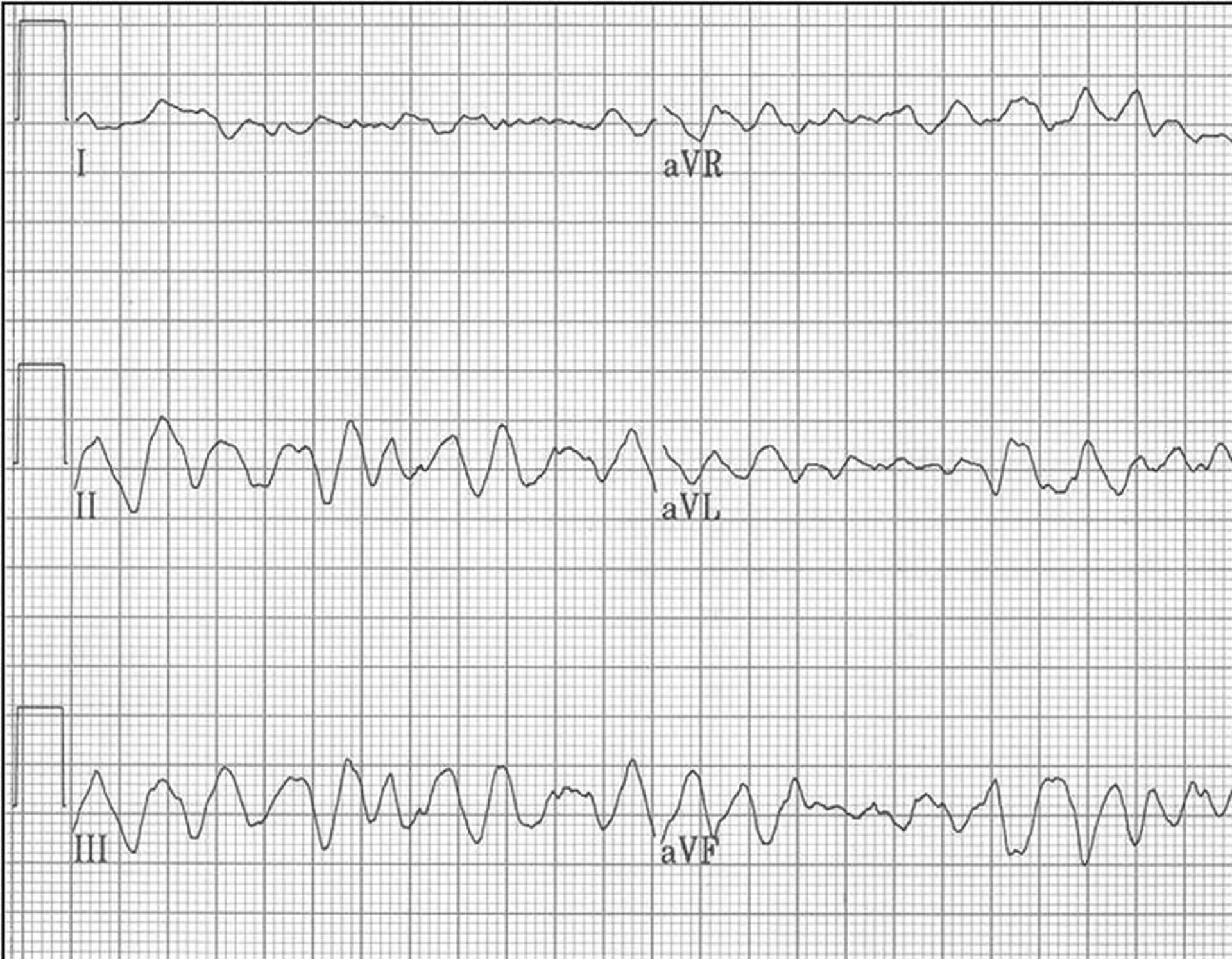 ECG, ventricular fibrillation, dog