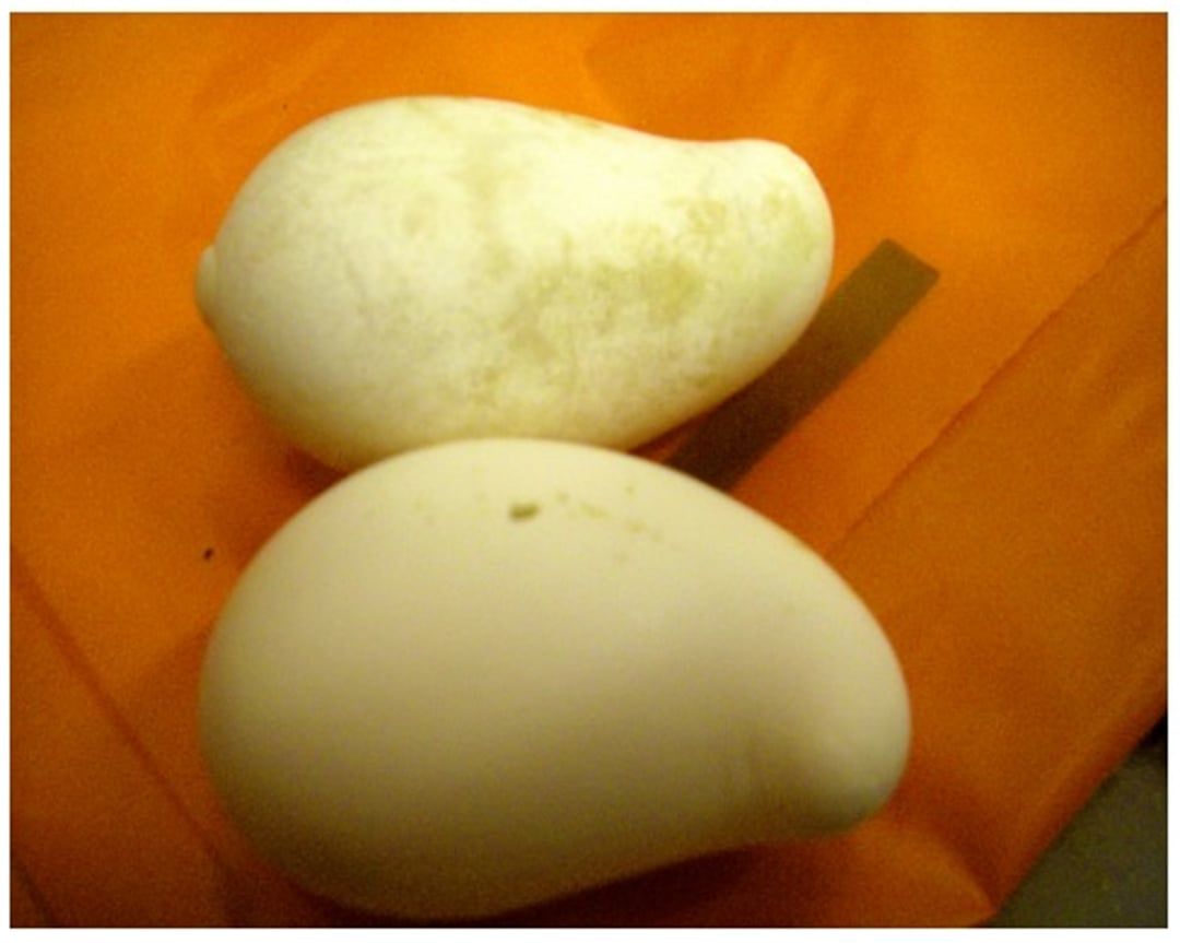Eggs, abnormal shape