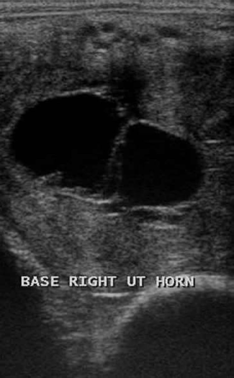 Endometrial cysts, mare