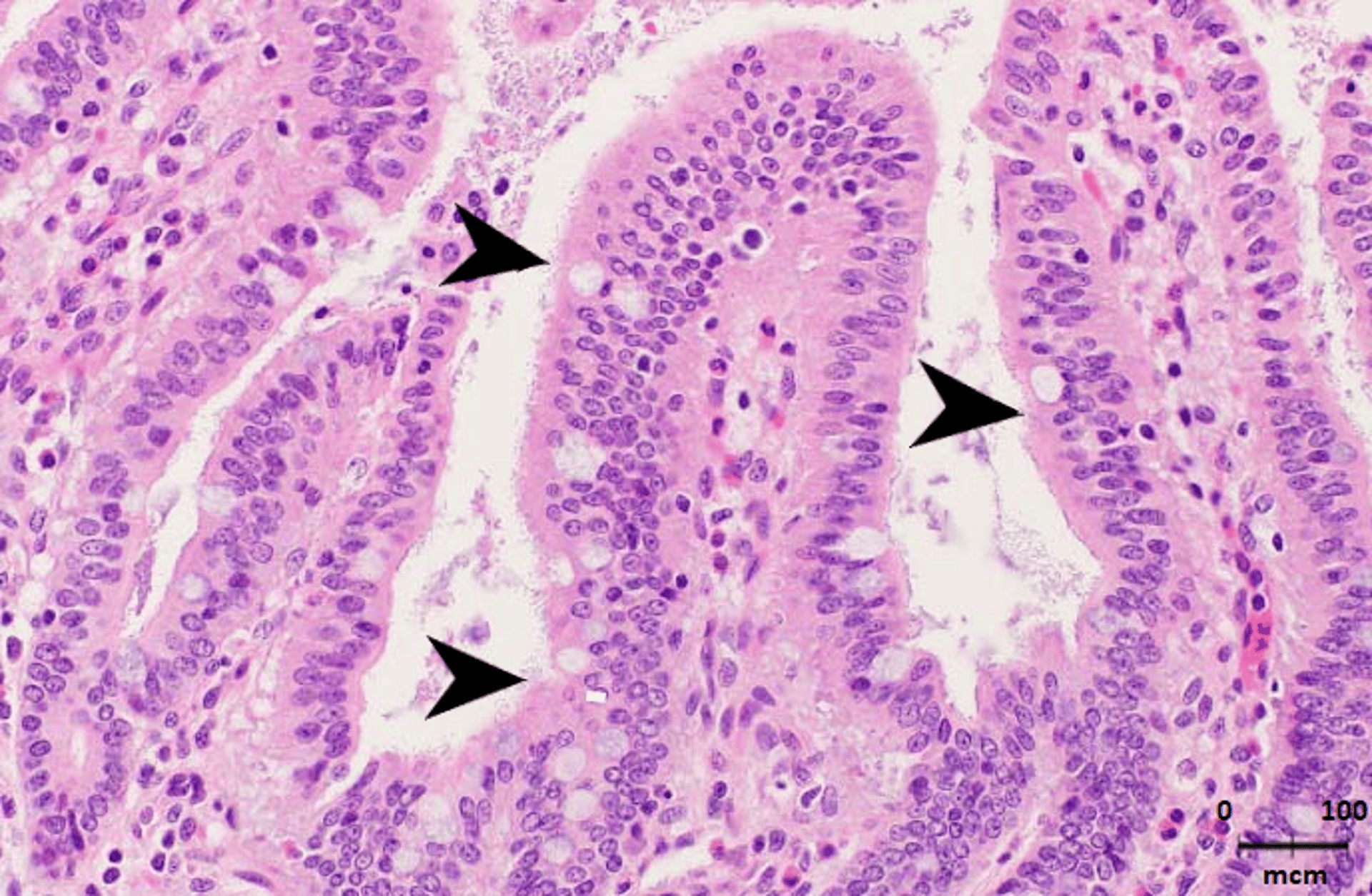 Enterotoxigenic <i >Escherichia coli</i>, histopathology, pig