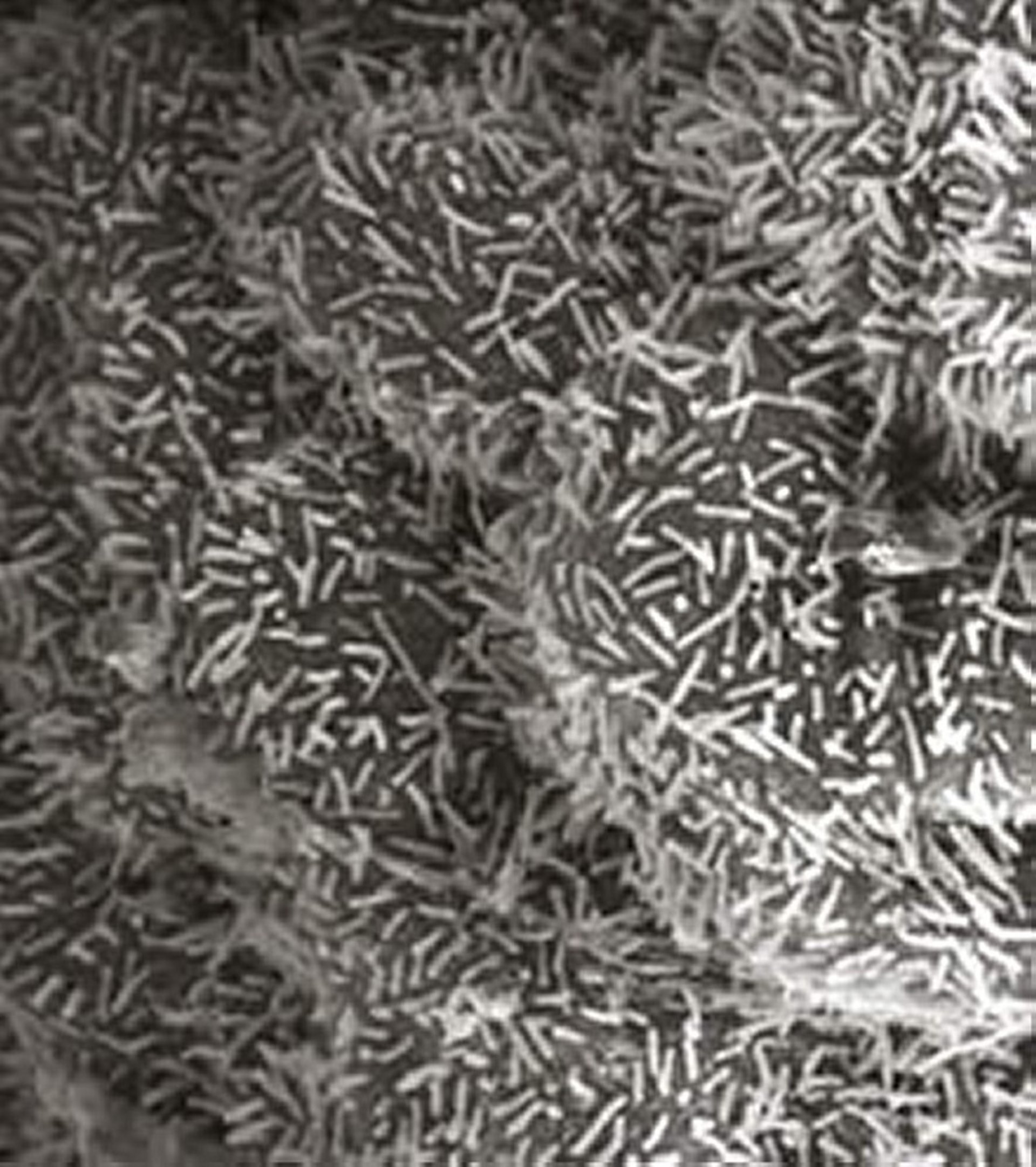 Enterotoxigenic <i >Escherichia coli</i>, intestine, calf