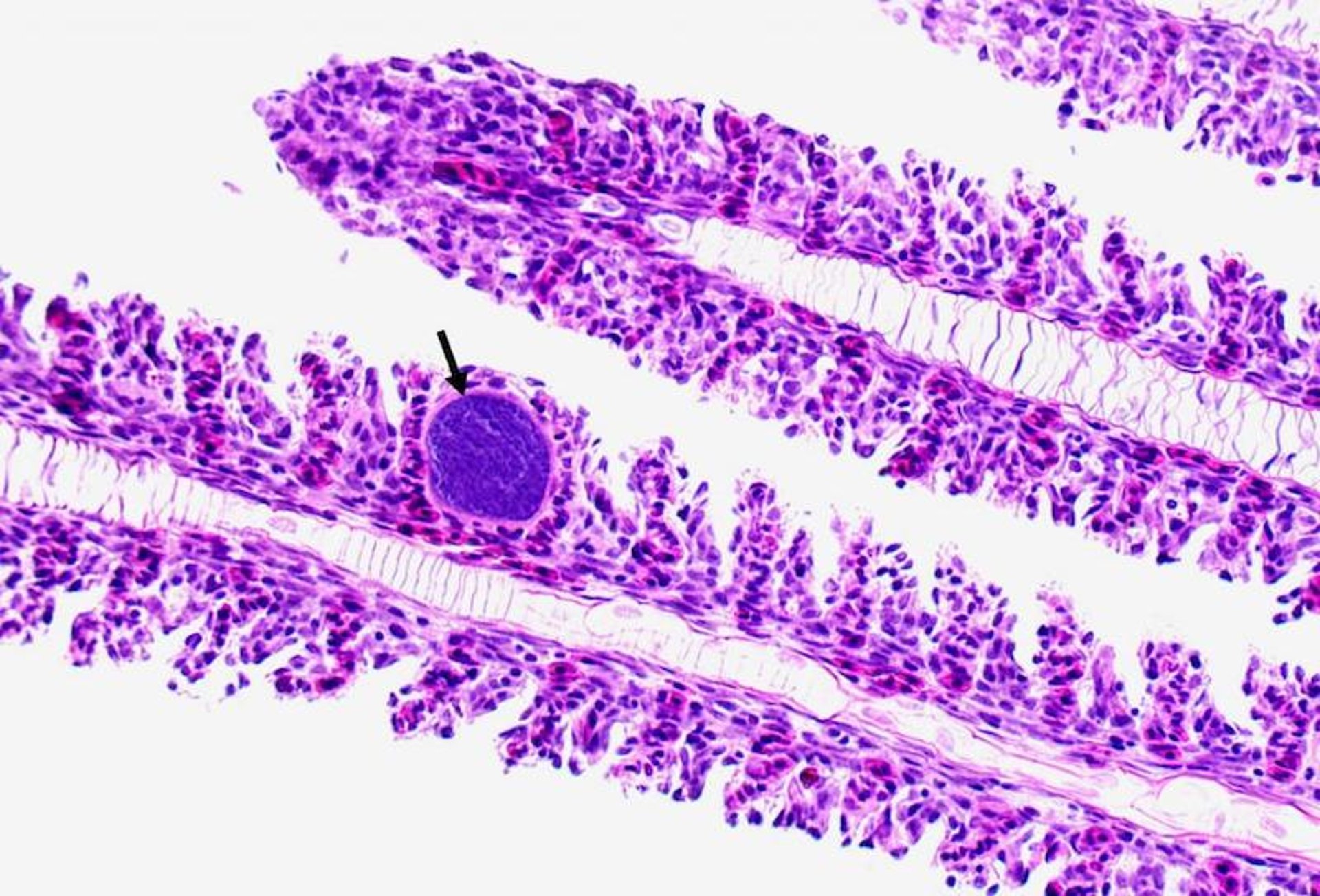 Epitheliocystis, oscar gill