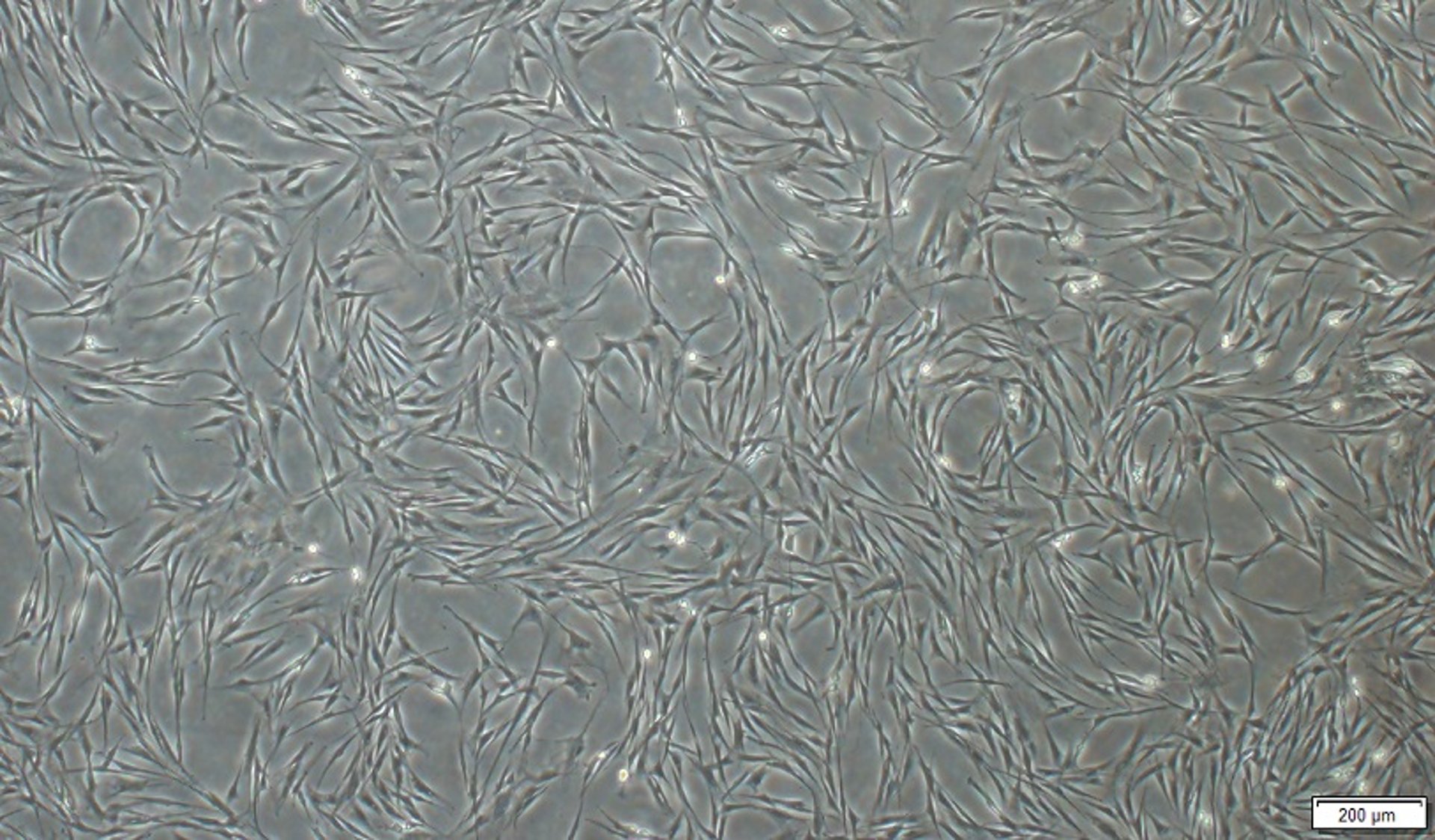 Mesenchymal stem cells, horse