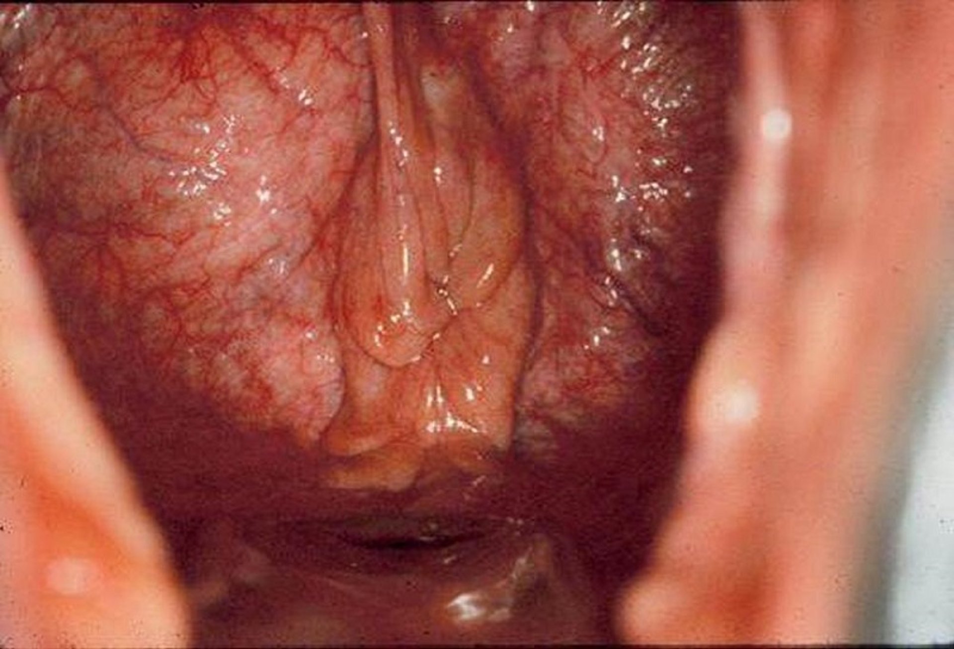 Estrous cervix, mare