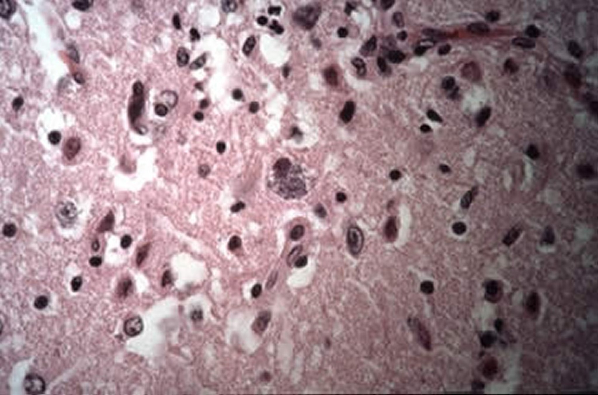 Intracellular cysts of <i >Encephalitozoon cuniculi</i>, brain, rabbit