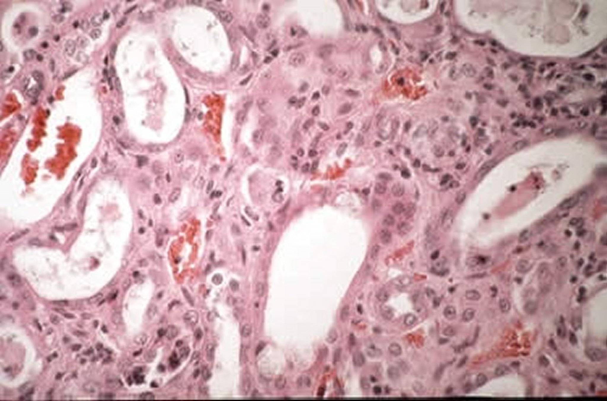 Intracellular cysts of <i >Encephalitozoon cuniculi</i>, renal cells, rabbit