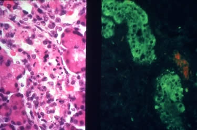 Destruction of ductal epithelial cells, parotid salivary gland, rat
