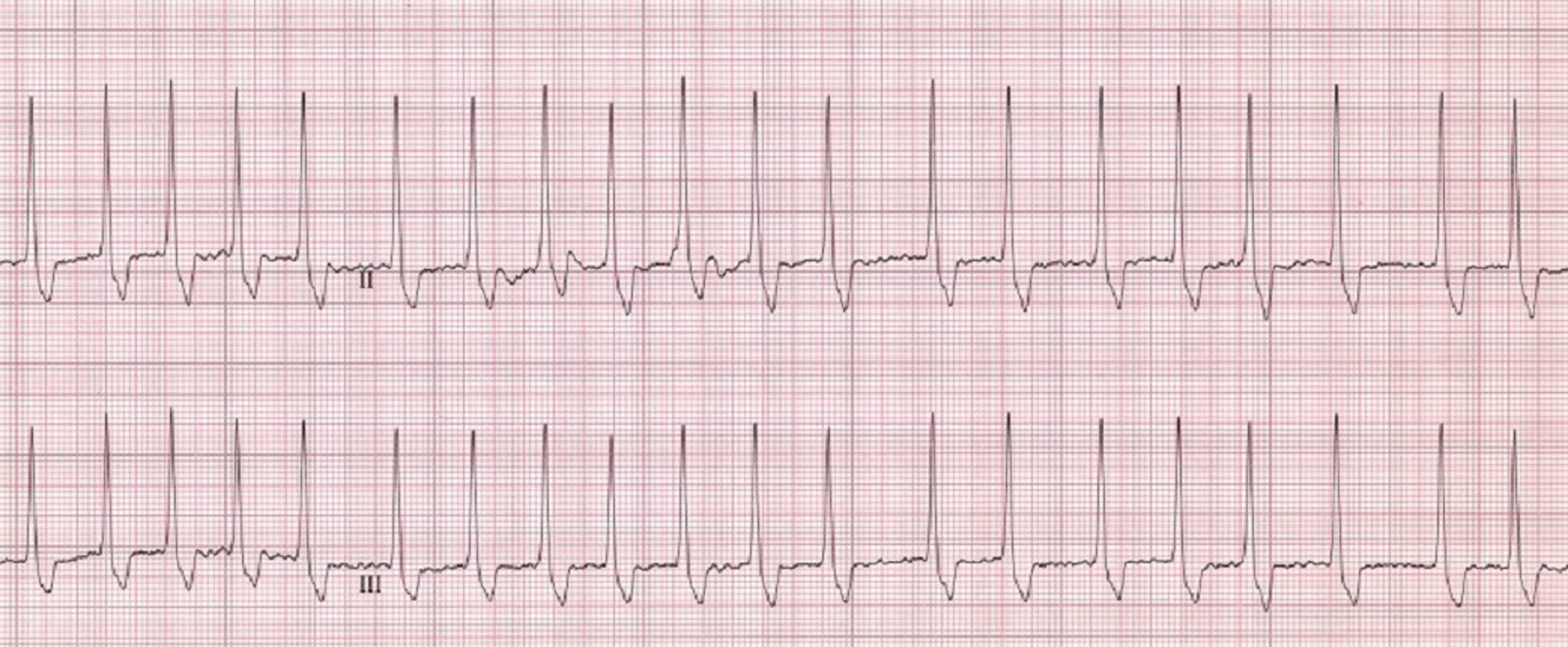 ECG, fibrilación auricular, perro