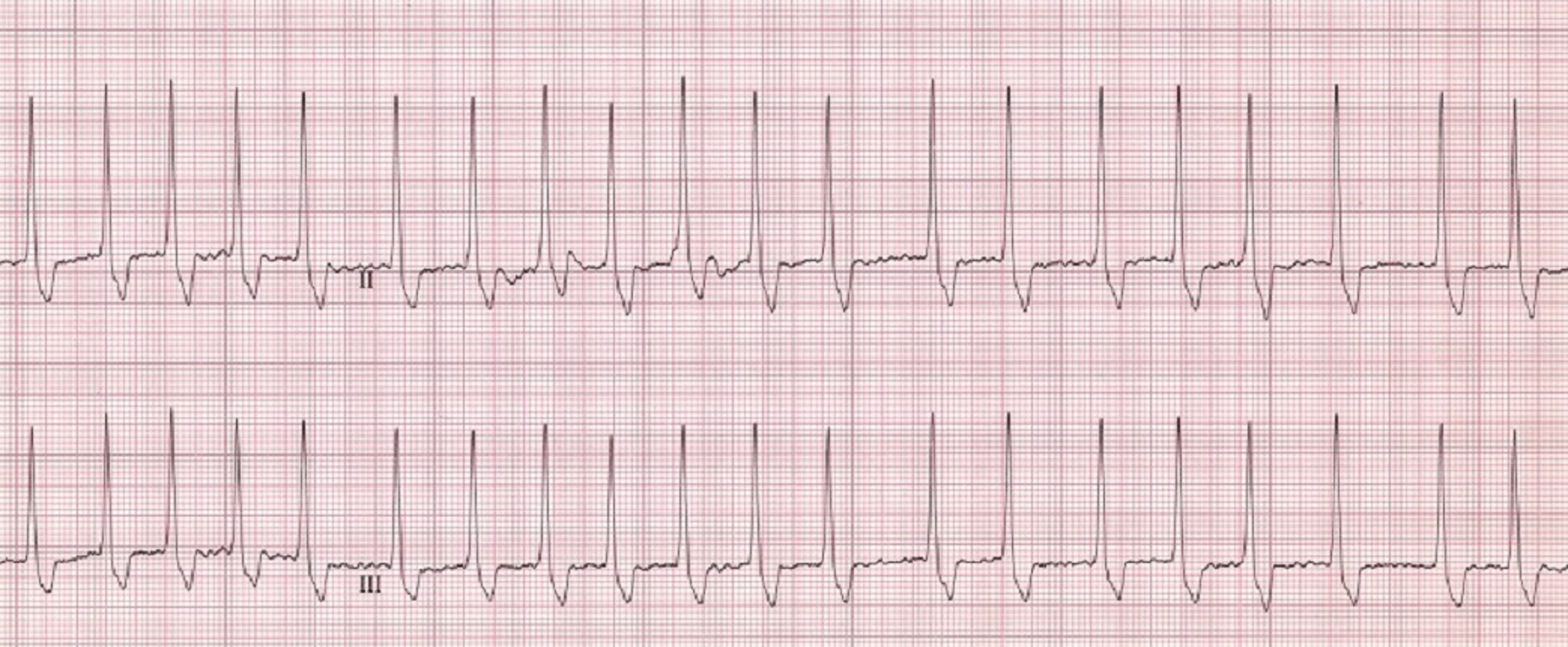 ECG, fibrilación auricular, perro