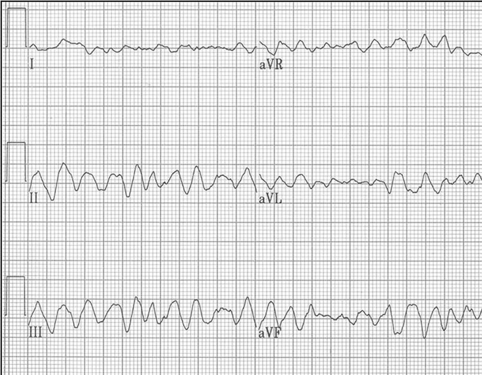 ECG, fibrilación ventricular, perro