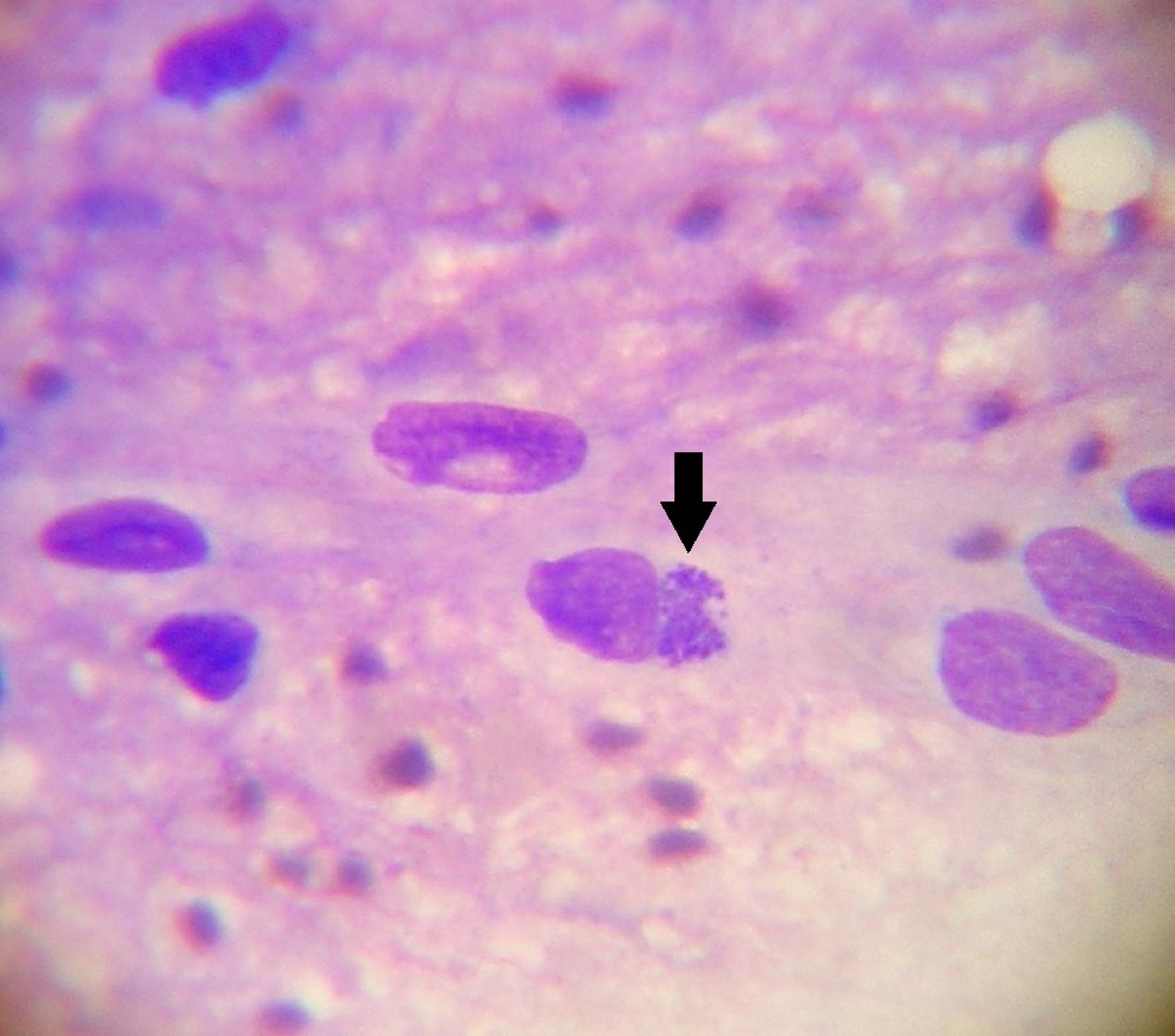 <i >Ehrlichia ruminantium</i> in endothelial cell