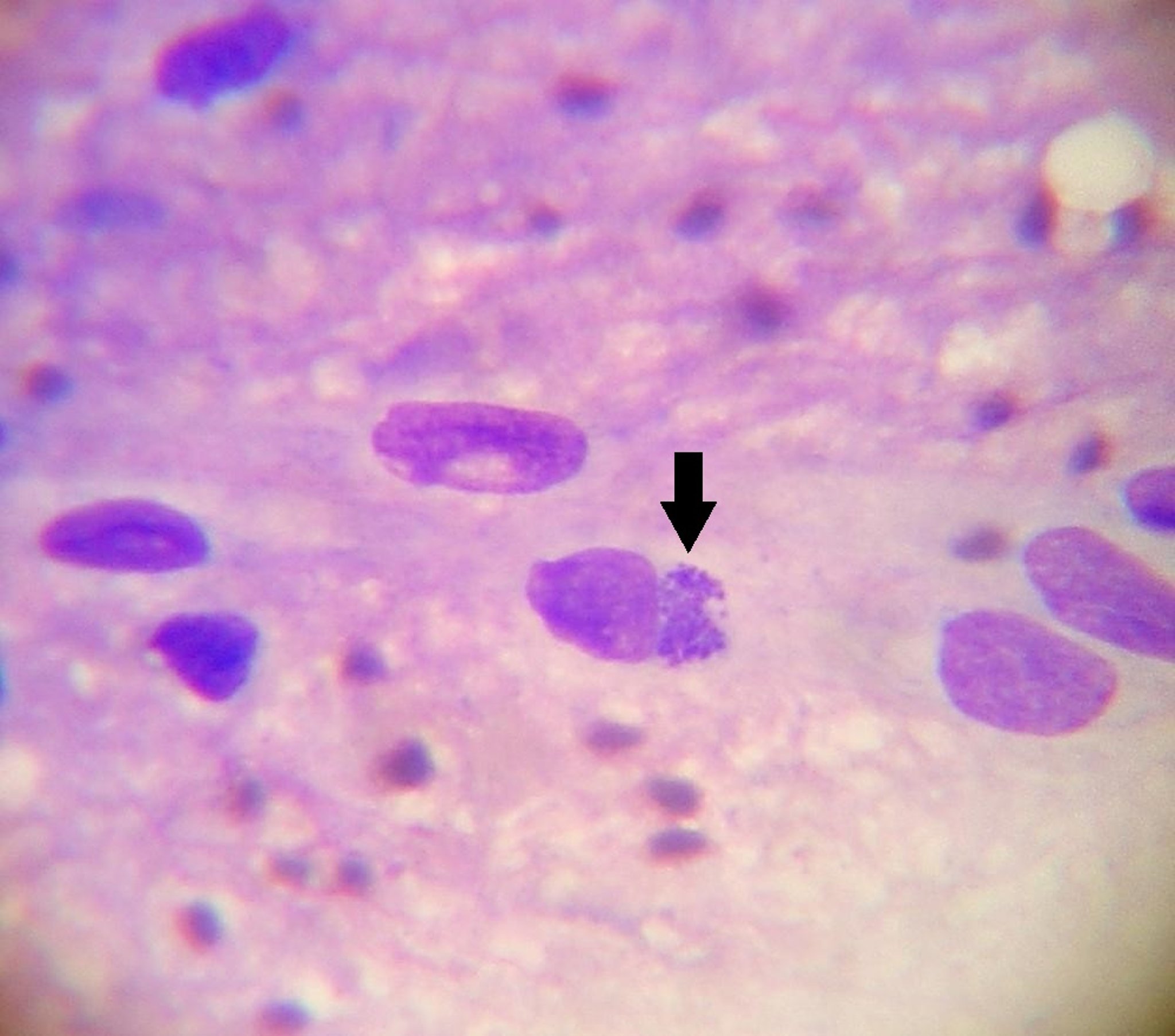 <i >Ehrlichia ruminantium</i> em célula endotelial