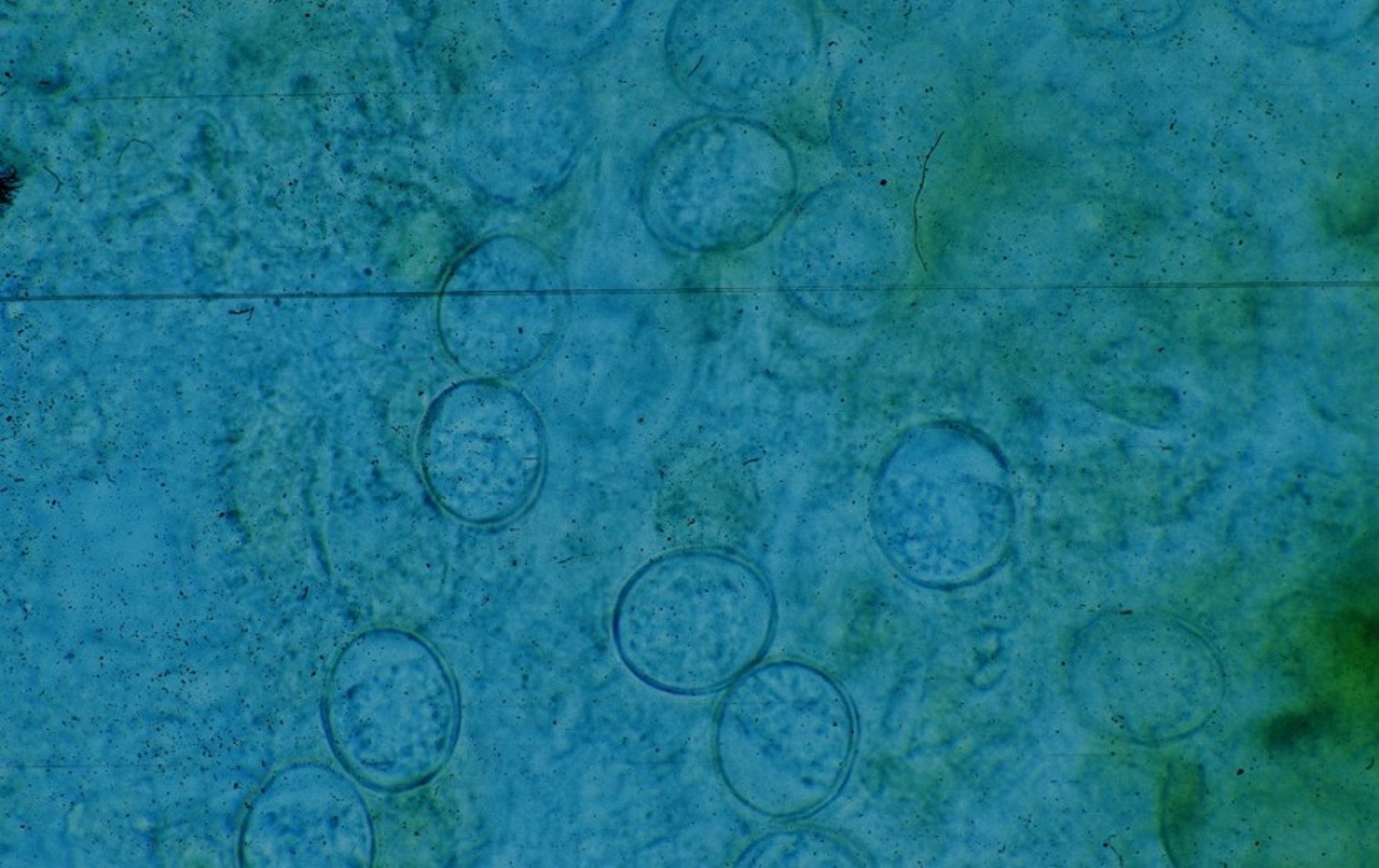 Ooquistes de <i >Eimeria zuernii</i>, frotis fecal, ternero