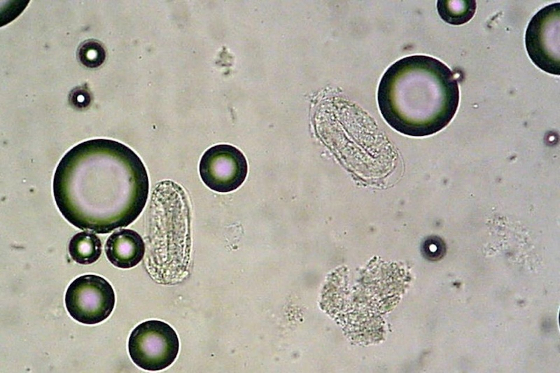 Ovos embrionados característicos de <i >Rhabdias</i> e <i >Strongyloides</i> em lavado pulmonar, píton-de-cabeça-preta