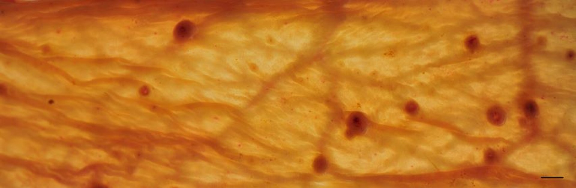 Larvas de ciatostomas enquistadas, caballo