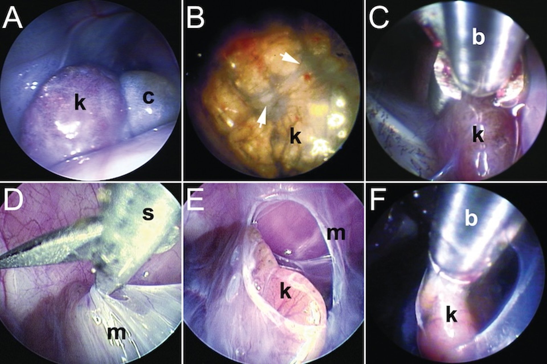 Patología endoscópica y biopsia renal, varios reptiles
