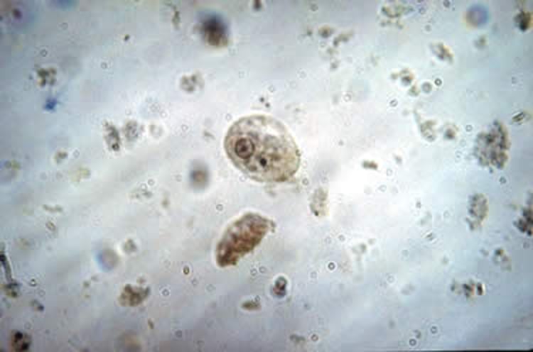 Cisto de <i >Entamoeba histolytica</i>